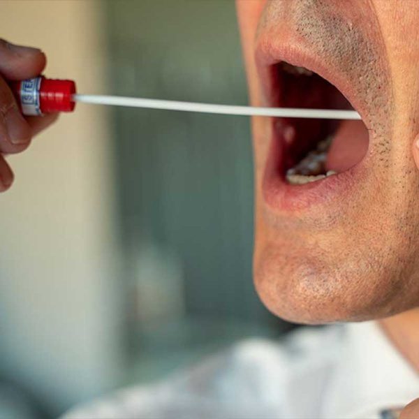 capillarium-test-genetico-alopecia-2 capillarium-test-genetico-alopecia-2